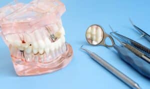 Orthodontist San Antonio