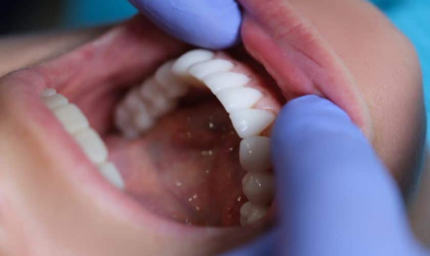 What Are The Different Types of Oral Surgery?
