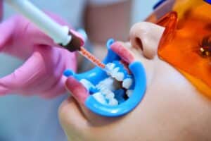 laser dentistry in child