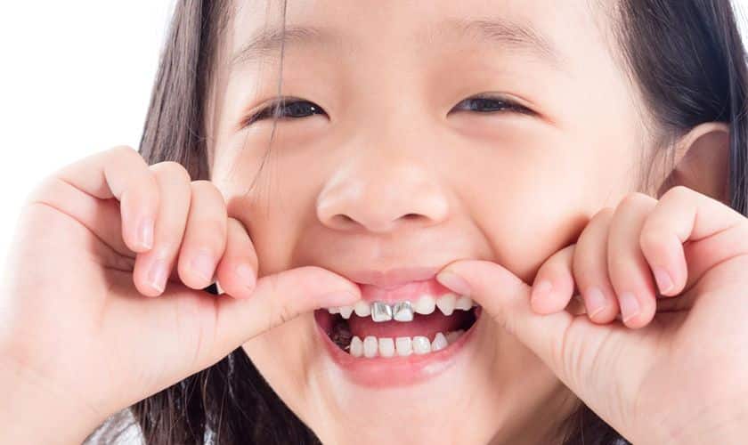 Pediatric Dentist in San Antonio Pediatric Dentist in San Antonio
