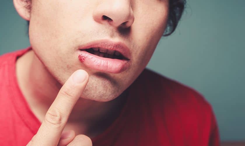 Early Signs of Oral Cancer