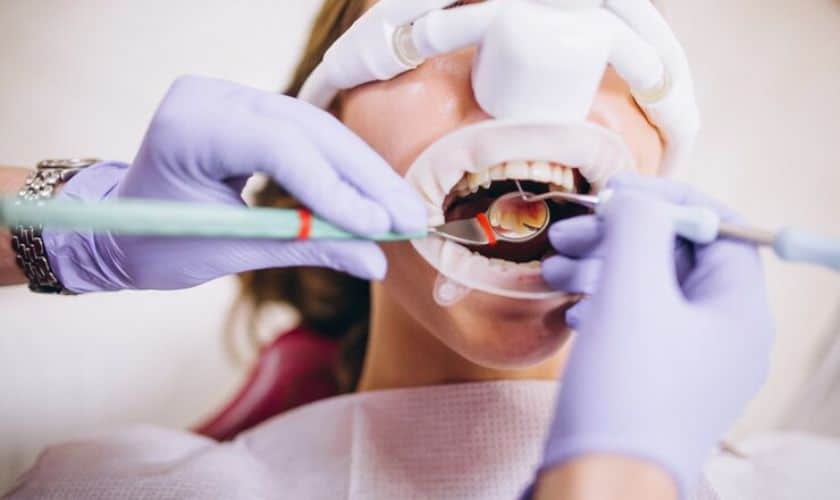 Different Stages of Orthodontic Treatment