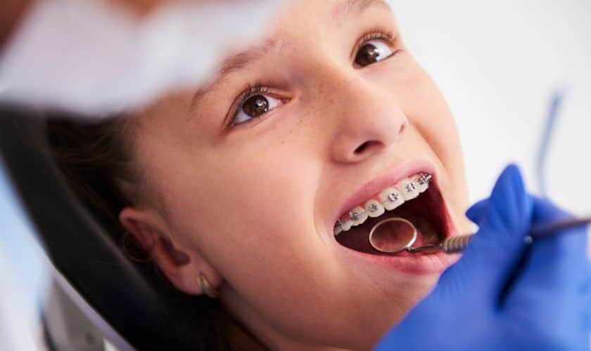 A Comprehensive Guide to Braces for Kids