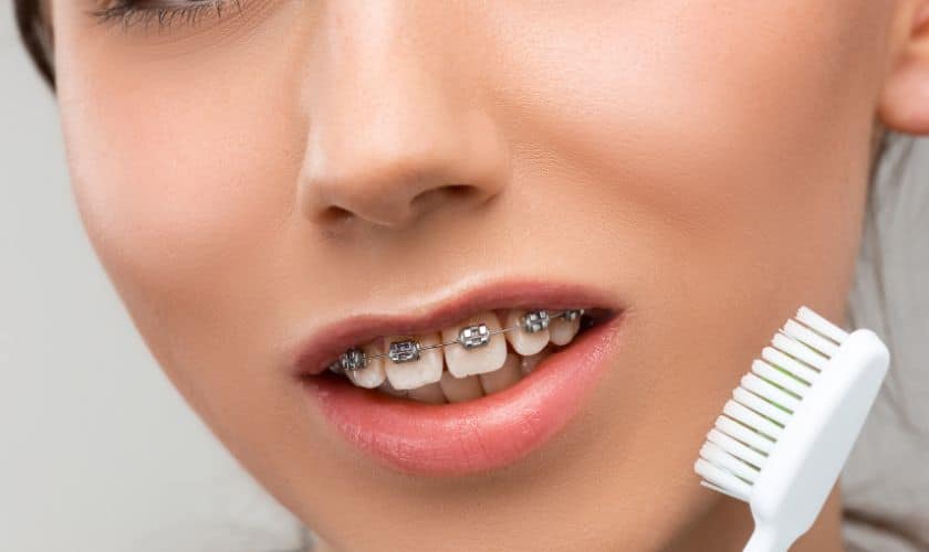 overbite overbite