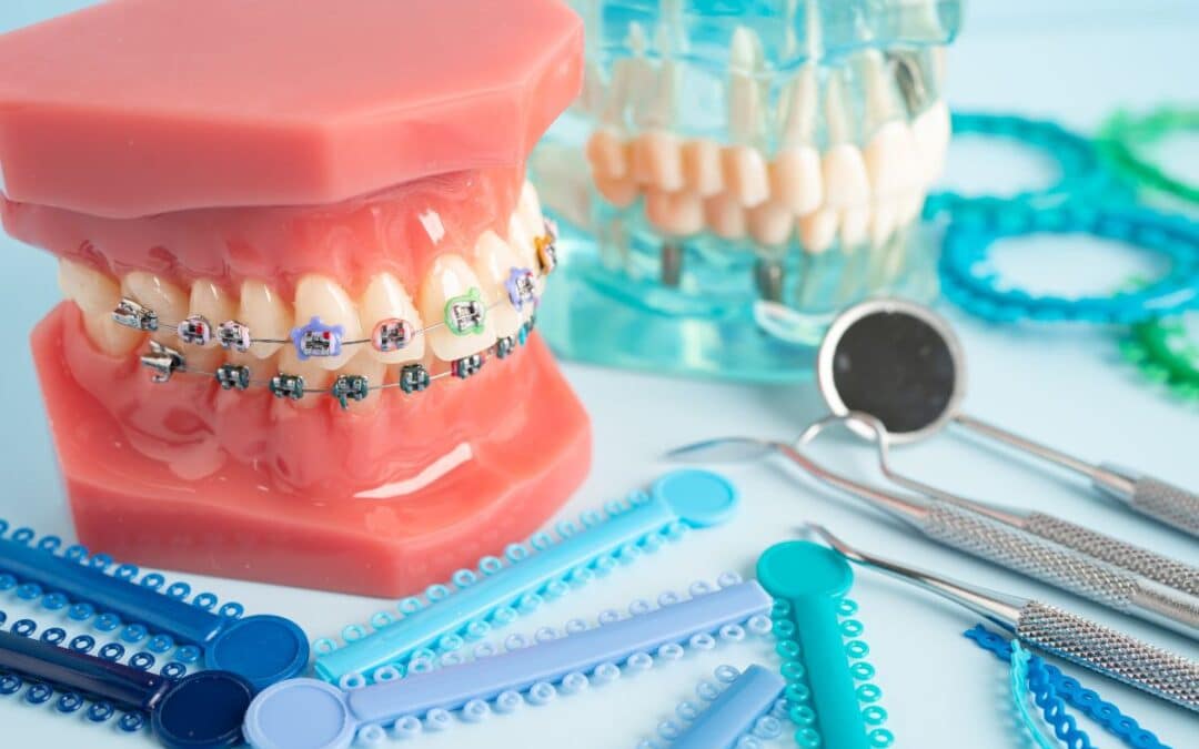 How to Maintain Oral Hygiene During Orthodontic Treatment