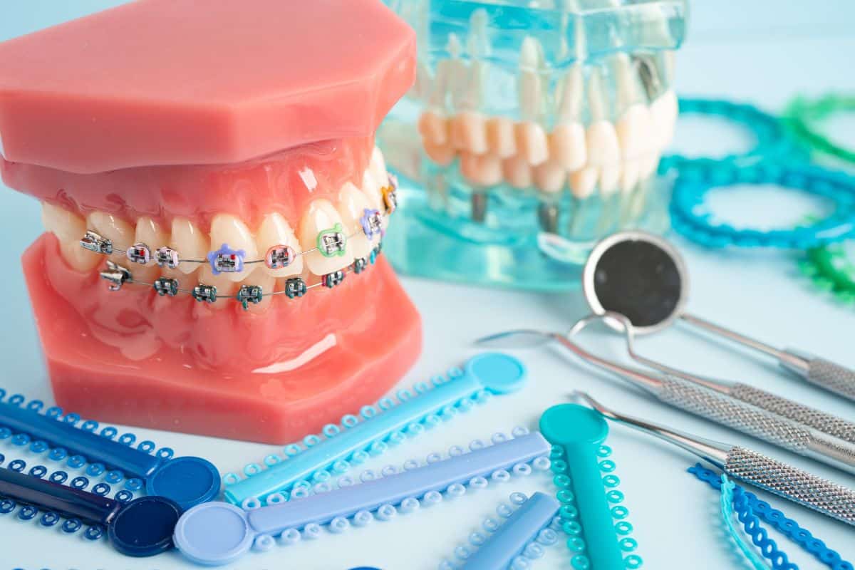 Orthodontic treatment Orthodontic treatment