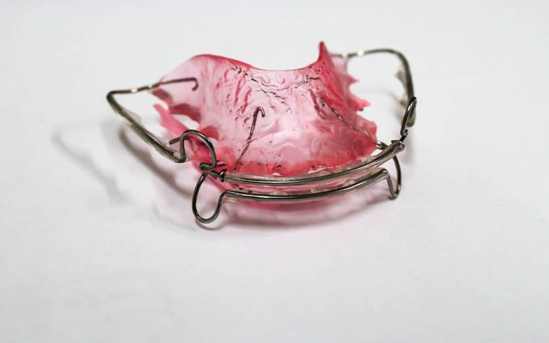 What Happens After Braces? Retainers and Maintaining Your New Smile