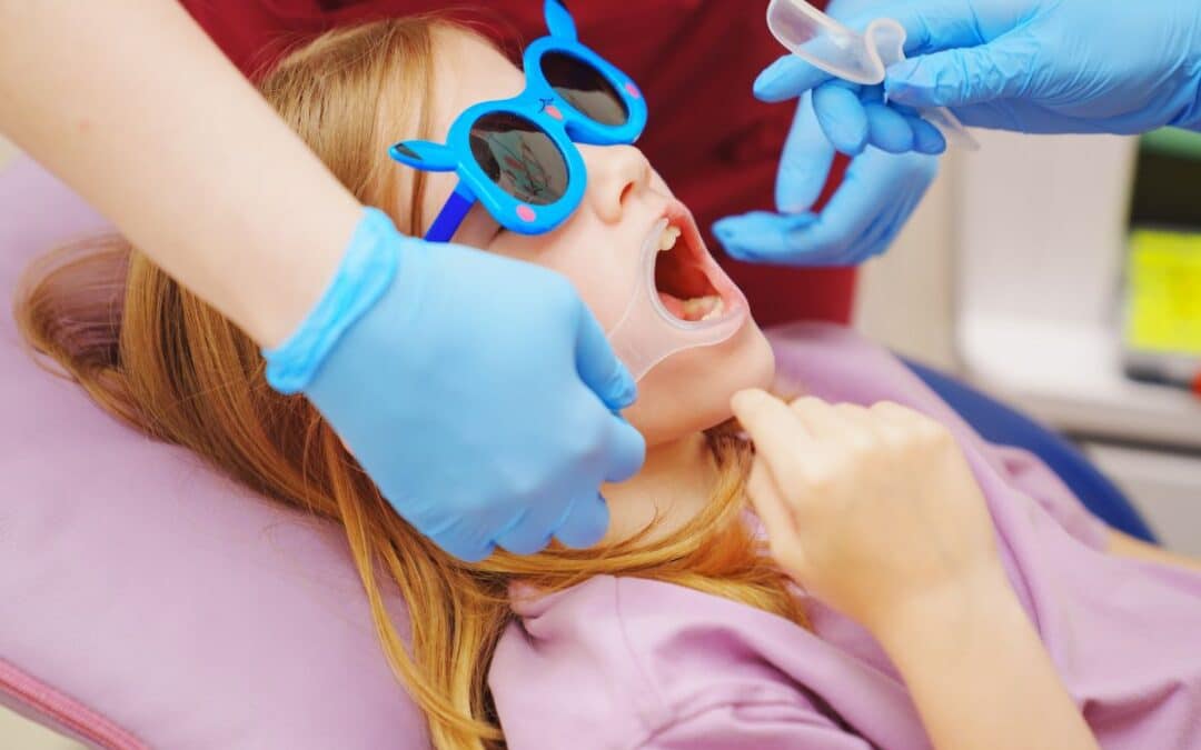 When Should Your Child Get A Space Maintainer?