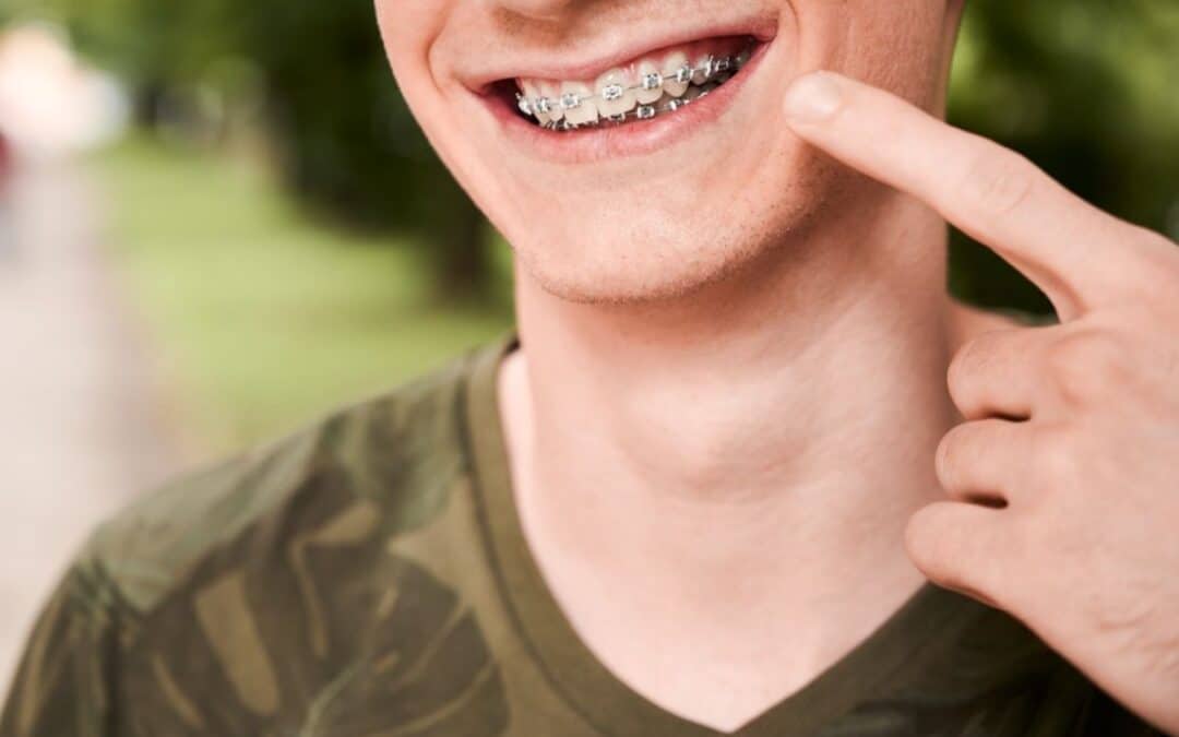 Can You Still Play Sports With Braces? Safety Tips You Need