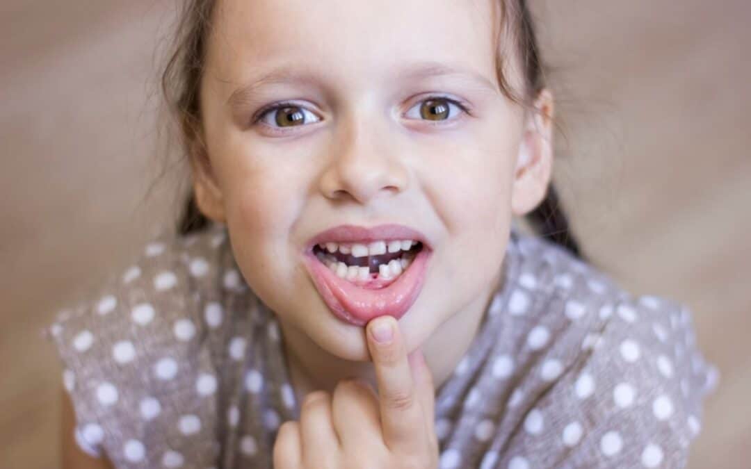 Premature Tooth Loss in Children: When Is It Too Soon?