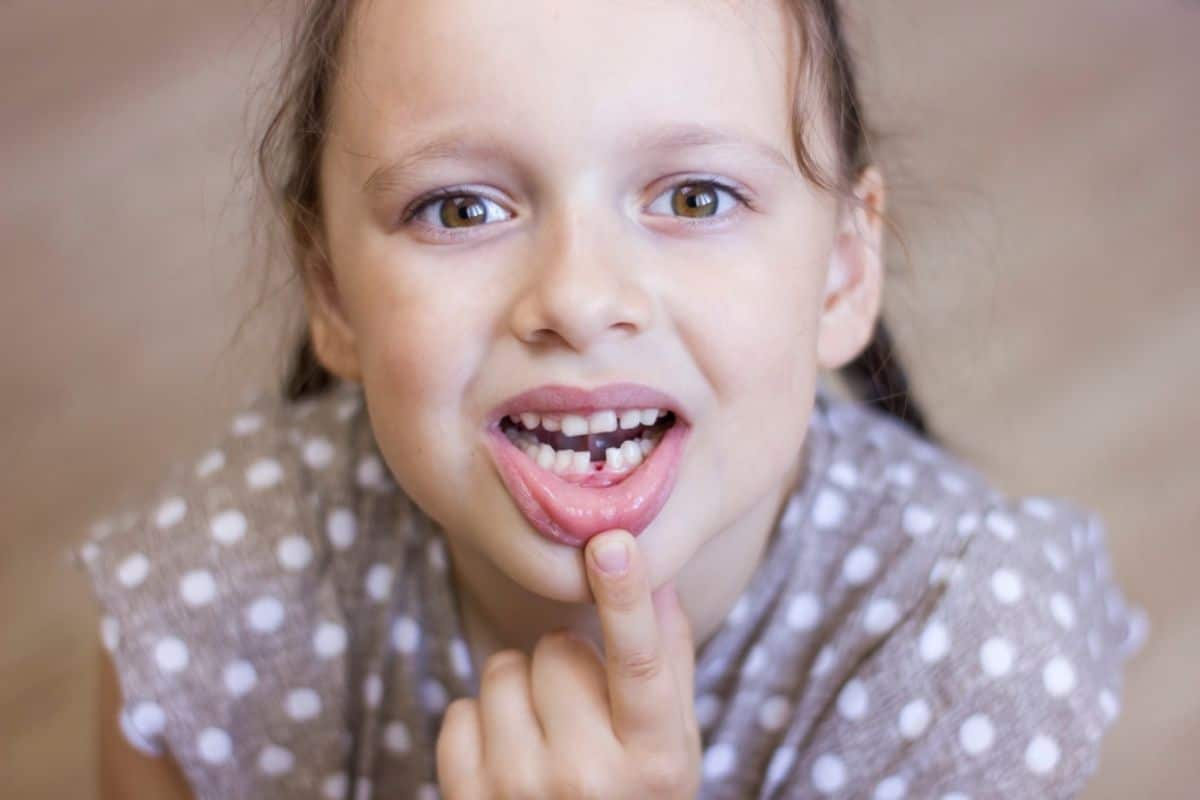Premature Tooth Loss in Children Premature Tooth Loss in Children