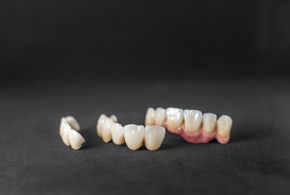 When Should Kids Get A Dental Crown? A Parent’s Guide