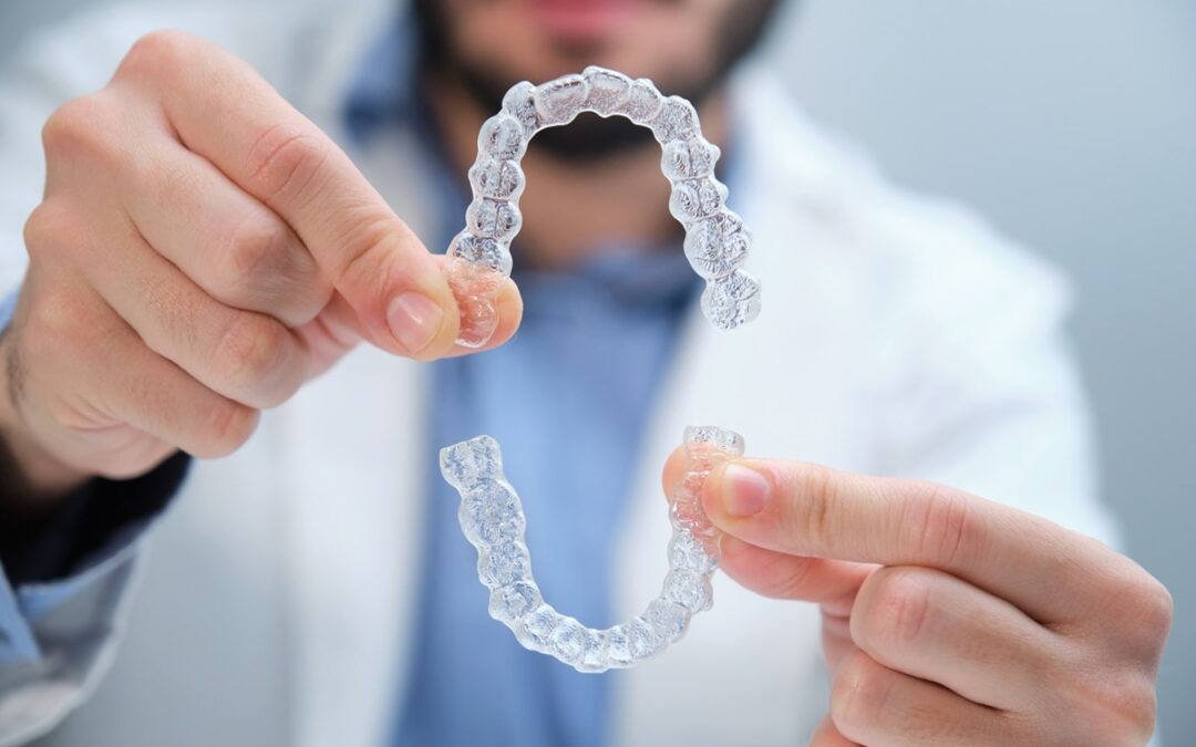 Top 5 Reasons San Antonio Adults Are Choosing Clear Aligners Over Braces